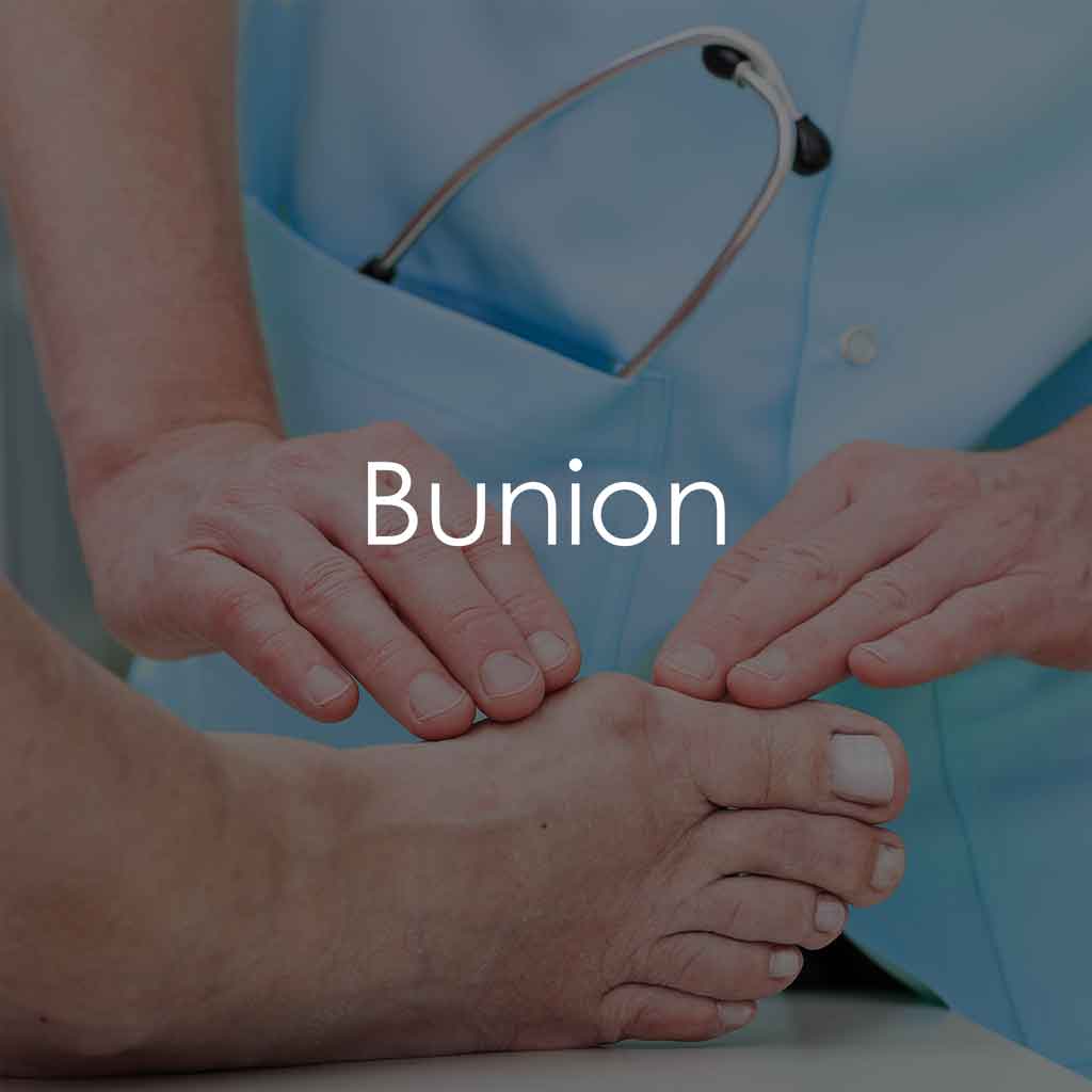 Services - Bunion