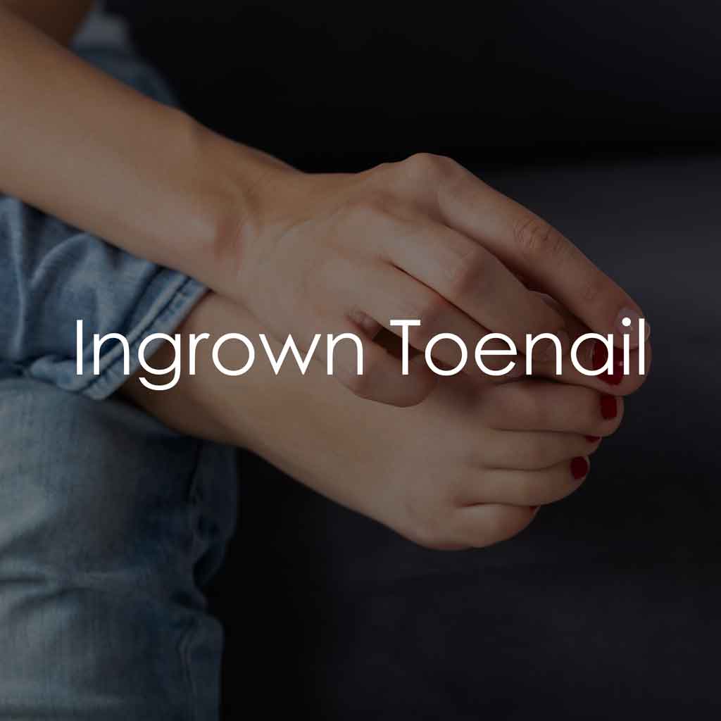 Services - Ingrown Toenail